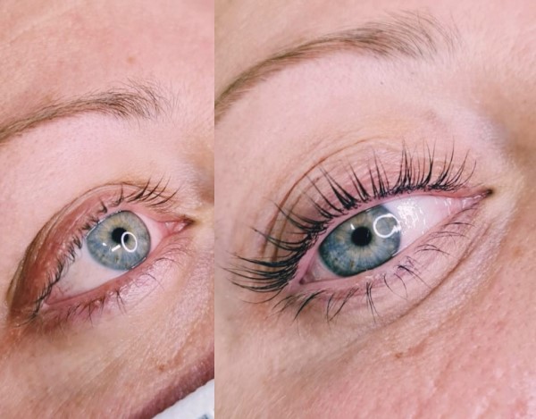 Wimpernlifting
